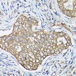 GTPBP9 Antibody in Immunohistochemistry (Paraffin) (IHC (P))