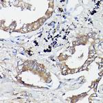 GTPBP9 Antibody in Immunohistochemistry (Paraffin) (IHC (P))