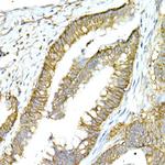 NKCC1 Antibody in Immunohistochemistry (Paraffin) (IHC (P))