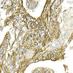 NKCC1 Antibody in Immunohistochemistry (Paraffin) (IHC (P))