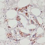 ACSL3 Antibody in Immunohistochemistry (Paraffin) (IHC (P))