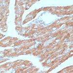 ACSL3 Antibody in Immunohistochemistry (Paraffin) (IHC (P))