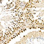 ALKBH5 Antibody in Immunohistochemistry (Paraffin) (IHC (P))