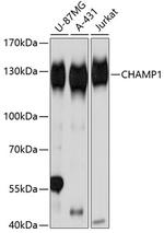 CHAMP1 Antibody in Western Blot (WB)