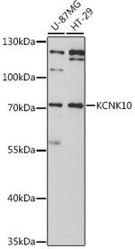 KCNK10 Antibody in Western Blot (WB)