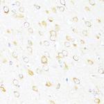 DDX3Y Antibody in Immunohistochemistry (Paraffin) (IHC (P))