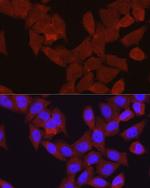 beta-Arrestin 2 Antibody in Immunocytochemistry (ICC/IF)