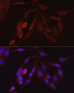 beta-Arrestin 2 Antibody in Immunocytochemistry (ICC/IF)