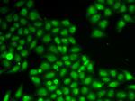 FEN1 Antibody in Immunocytochemistry (ICC/IF)