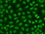 FEN1 Antibody in Immunocytochemistry (ICC/IF)