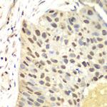 FEN1 Antibody in Immunohistochemistry (Paraffin) (IHC (P))