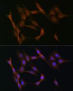 TGFBR2 Antibody in Immunocytochemistry (ICC/IF)