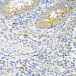 TGFBR2 Antibody in Immunohistochemistry (Paraffin) (IHC (P))