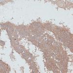 TGFBR2 Antibody in Immunohistochemistry (Paraffin) (IHC (P))