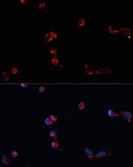 Catalase Antibody in Immunocytochemistry (ICC/IF)