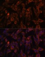 TLR3 Antibody in Immunocytochemistry (ICC/IF)