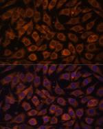 TLR3 Antibody in Immunocytochemistry (ICC/IF)