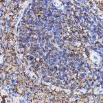 TGFBR2 Antibody in Immunohistochemistry (Paraffin) (IHC (P))