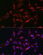 RAB5 Antibody in Immunocytochemistry (ICC/IF)