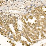 RAB5 Antibody in Immunohistochemistry (Paraffin) (IHC (P))