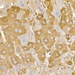 RAB5 Antibody in Immunohistochemistry (Paraffin) (IHC (P))