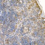 RAB5 Antibody in Immunohistochemistry (Paraffin) (IHC (P))