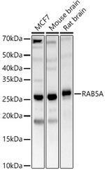 RAB5 Antibody in Western Blot (WB)