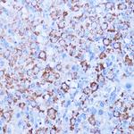 ISG15 Antibody in Immunohistochemistry (Paraffin) (IHC (P))