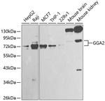 GGA2 Antibody in Western Blot (WB)