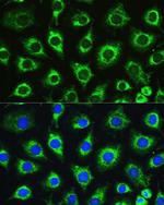 ATG16L1 Antibody in Immunocytochemistry (ICC/IF)