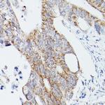 ATG16L1 Antibody in Immunohistochemistry (Paraffin) (IHC (P))