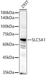 SGLT1 Antibody in Western Blot (WB)