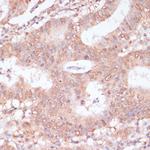 BYSL Antibody in Immunohistochemistry (Paraffin) (IHC (P))