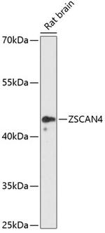 ZSCAN4 Antibody in Western Blot (WB)