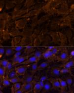 MMP3 Antibody in Immunocytochemistry (ICC/IF)