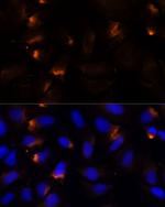 MMP3 Antibody in Immunocytochemistry (ICC/IF)