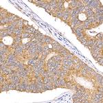 TAK1 Antibody in Immunohistochemistry (Paraffin) (IHC (P))