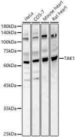 TAK1 Antibody in Western Blot (WB)