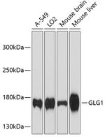 GLG1 Antibody in Western Blot (WB)
