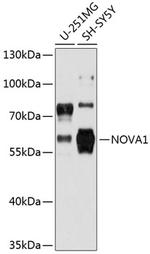 NOVA1 Antibody in Western Blot (WB)