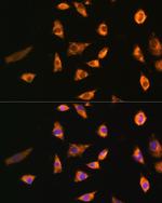 SPRR3 Antibody in Immunocytochemistry (ICC/IF)