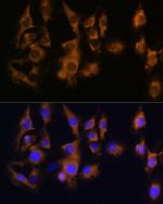 SPRR3 Antibody in Immunocytochemistry (ICC/IF)