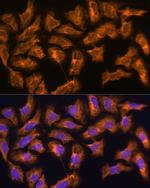 SPRR3 Antibody in Immunocytochemistry (ICC/IF)