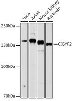 GIGYF2 Antibody in Western Blot (WB)