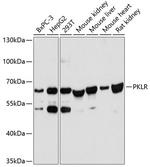 PKLR Antibody in Western Blot (WB)