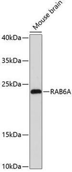 RAB6A Antibody in Western Blot (WB)