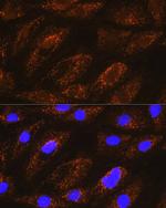 NDUFA8 Antibody in Immunocytochemistry (ICC/IF)