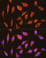 NDUFA8 Antibody in Immunocytochemistry (ICC/IF)