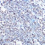 SART3 Antibody in Immunohistochemistry (Paraffin) (IHC (P))