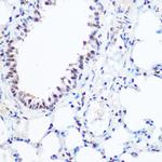 SART3 Antibody in Immunohistochemistry (Paraffin) (IHC (P))